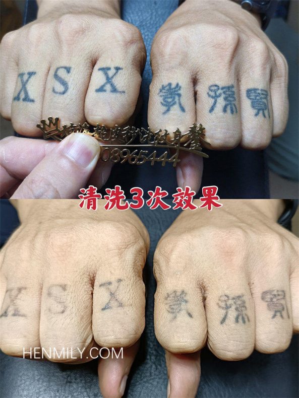恒美丽医美案例-面对挑战：···