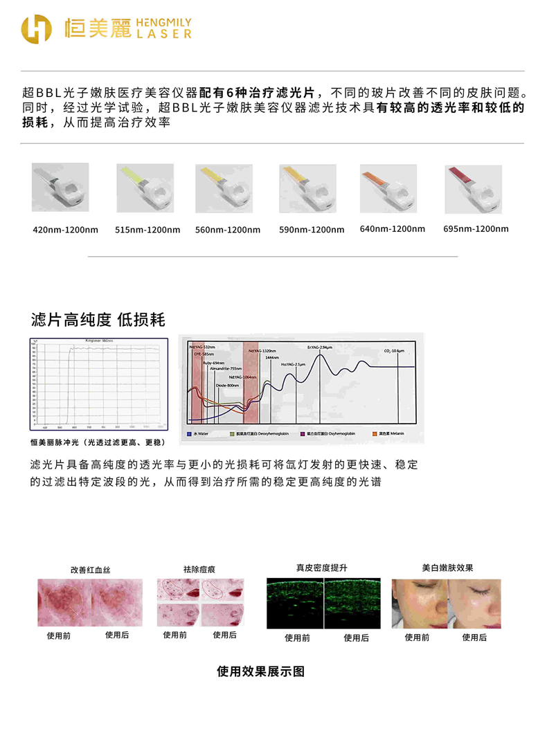 超光子3.jpg