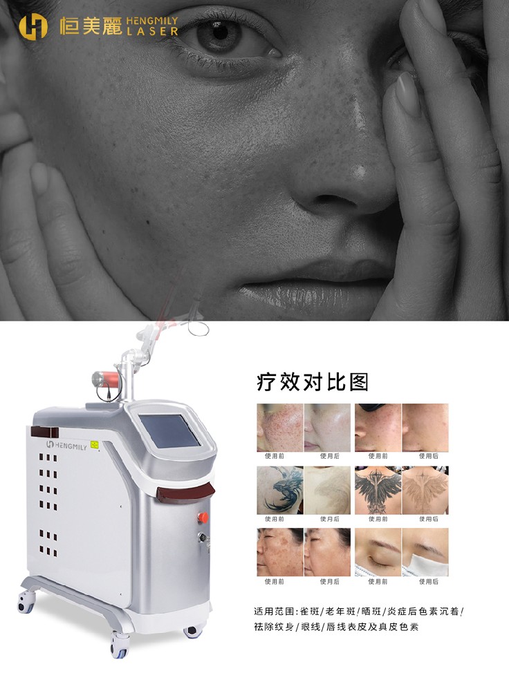 调Q激光祛斑仪器多少钱一台