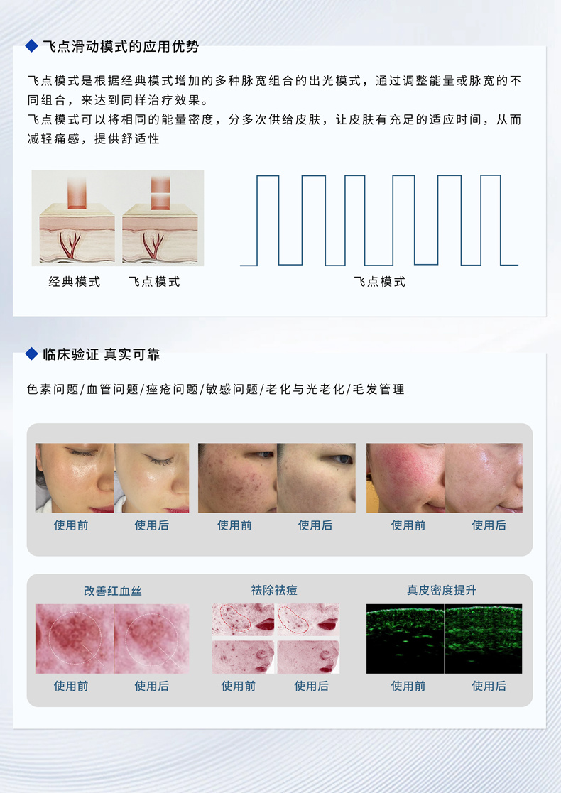 超BBL简介5.jpg